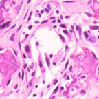 MENDEL MASTERY SERIES™: BONE TUMORS