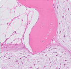 MENDEL MASTERY SERIES™: BONE & SOFT-TISSUE TUMORS