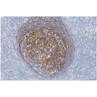 IHC: In germinal center